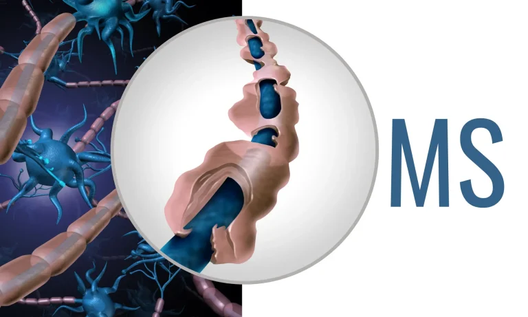 Depression (20 x 12 cm)