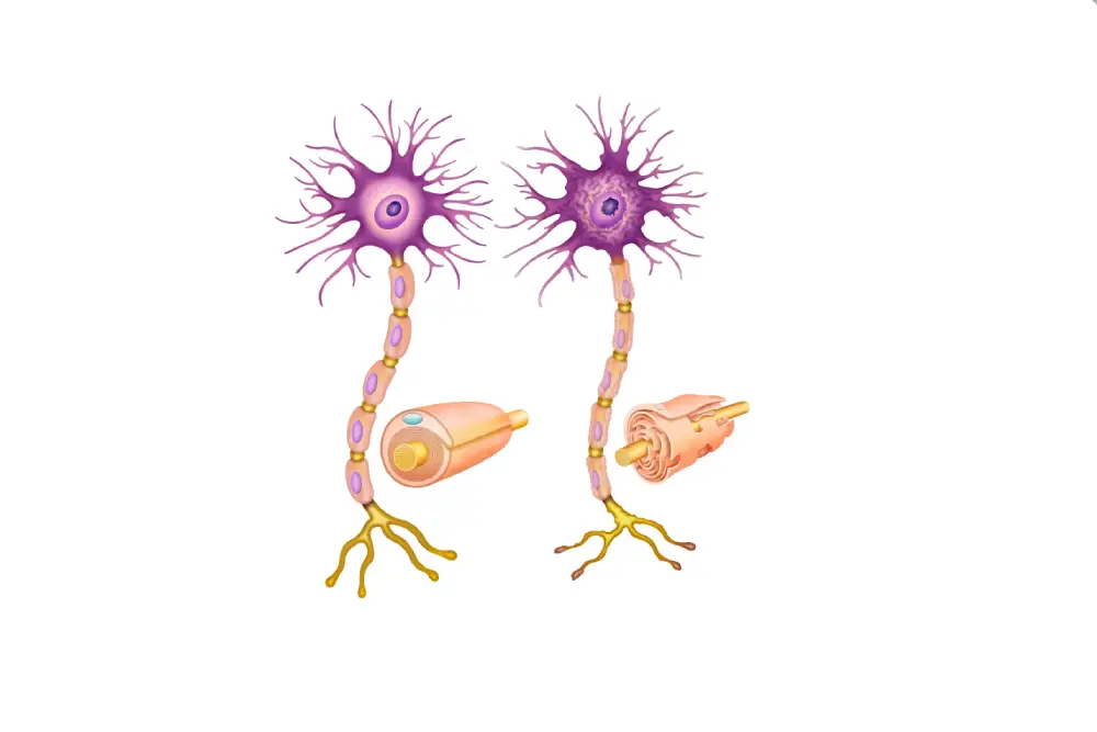 Understanding Multiple Sclerosis Polymedica Clinics Understanding multiple sclerosis polymedica clinics